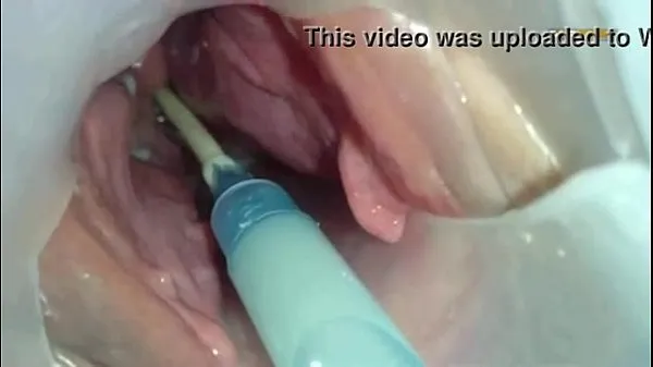 Hot Sperm injected into the uterus of the wife of others fresh Tube