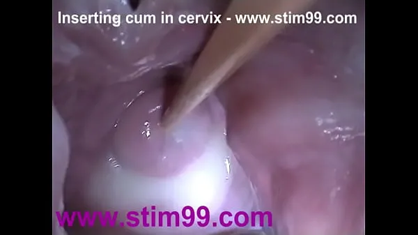 Caldo Inserimento dello sperma in cervice Ampio speculum della figa che si estendetubo fresco