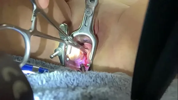 Hot Grim tool grips cervix fresh Tube